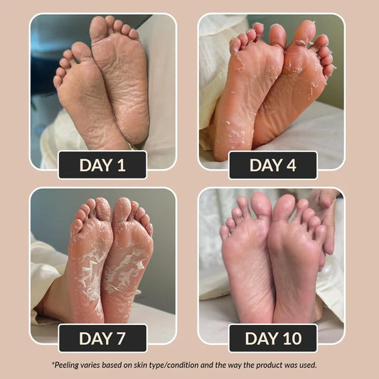 Lumèon Seoul Glycolic Acid Foot Peeling Mask(BUY 1 GET 1 FREE)